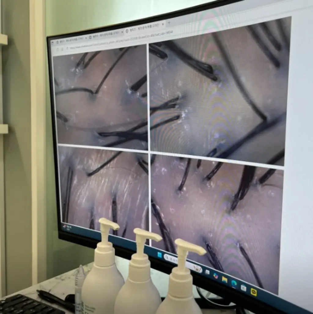 hair_follicle_exam_on_screen_48275