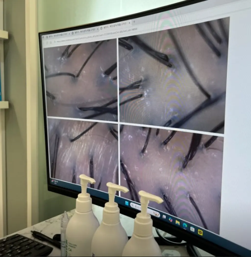 hair_follicle_scalp_analysis_29385.webp