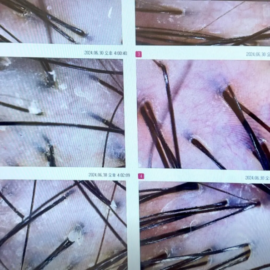 hair_follicle_scalp_close_view_18532