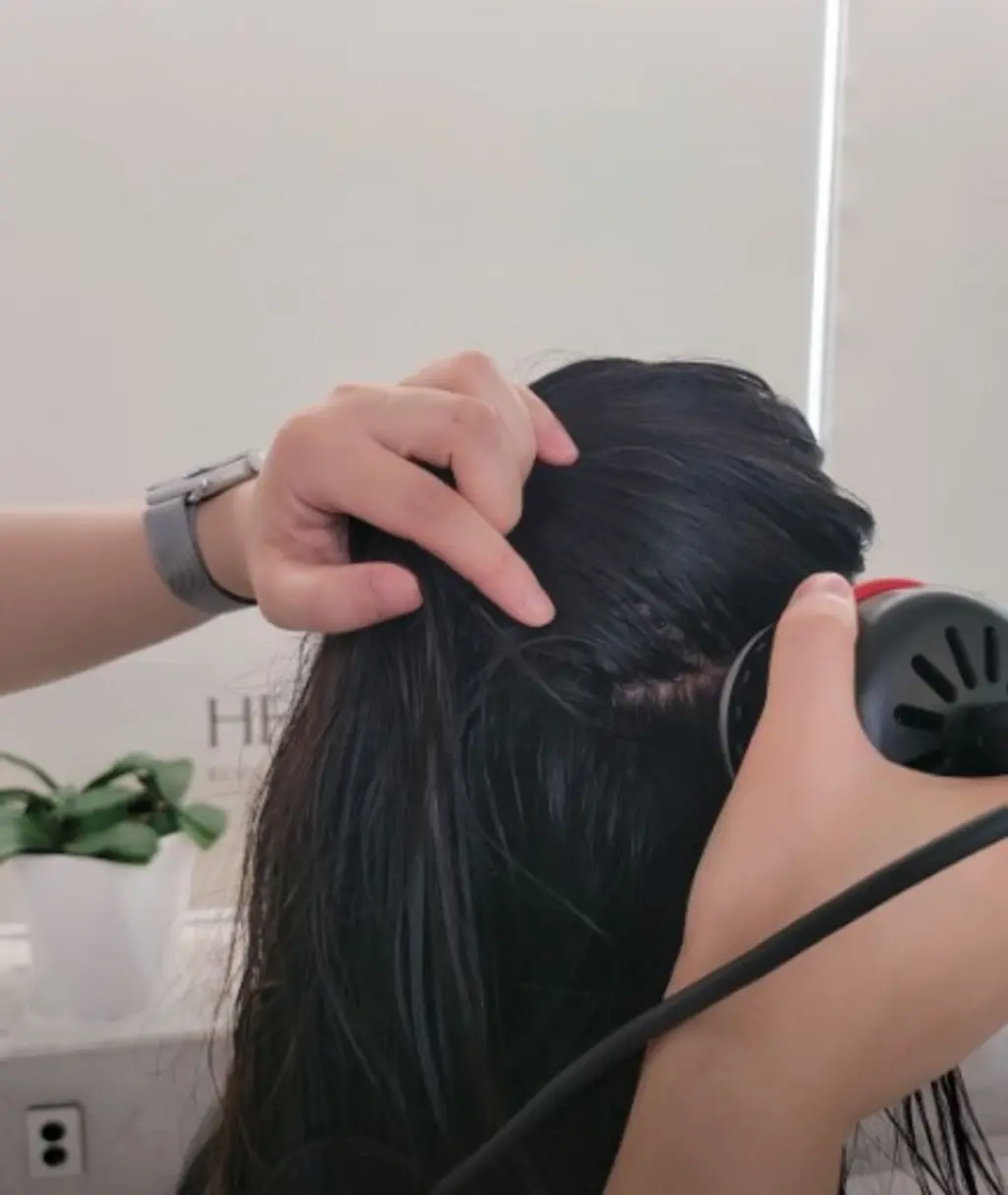 hair_treatment_scalp_care_woman_38521.webp