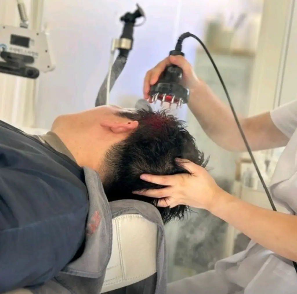 레이저 기기를 이용한 전문 두피 케어