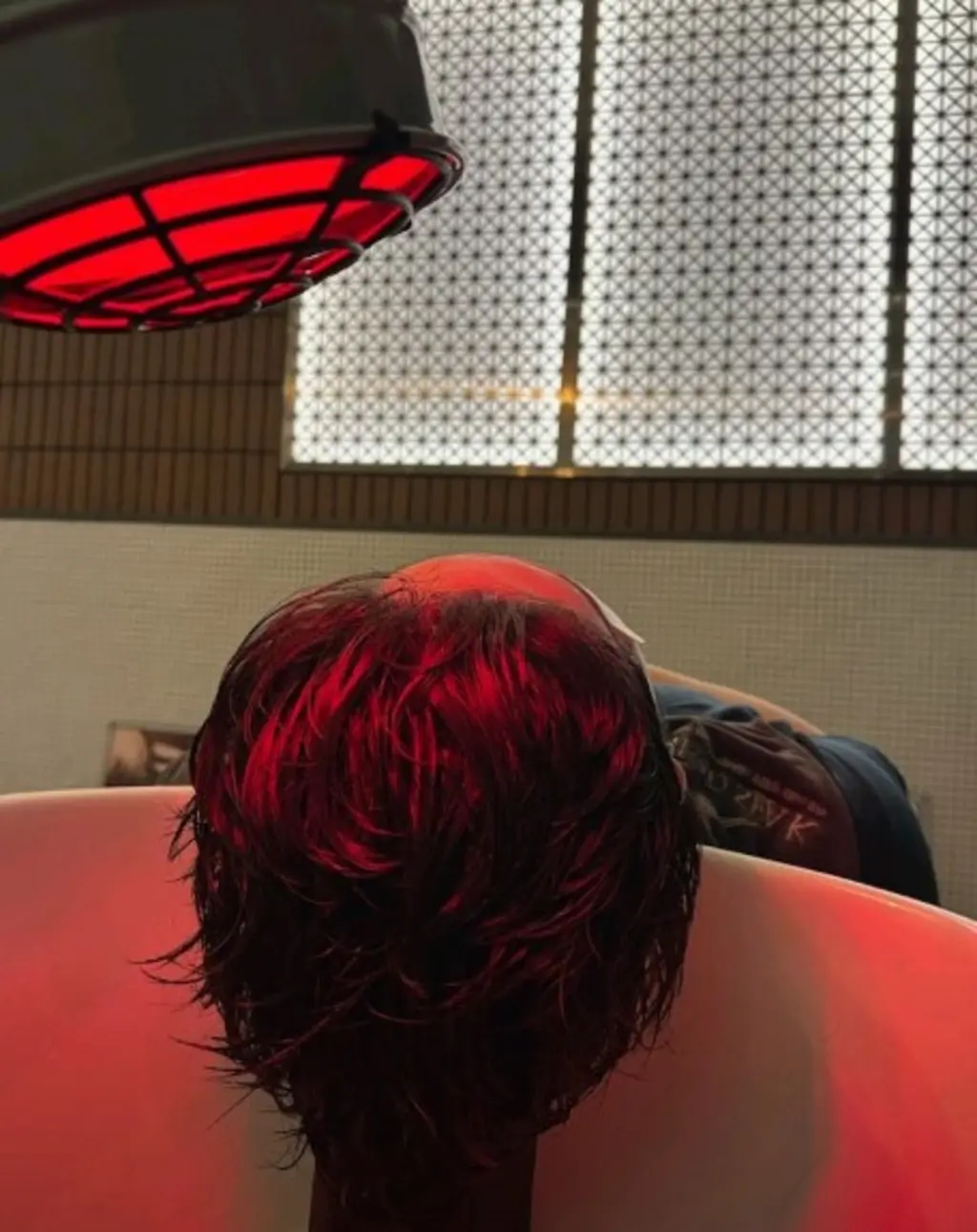 열 램프 치료 중인 모발