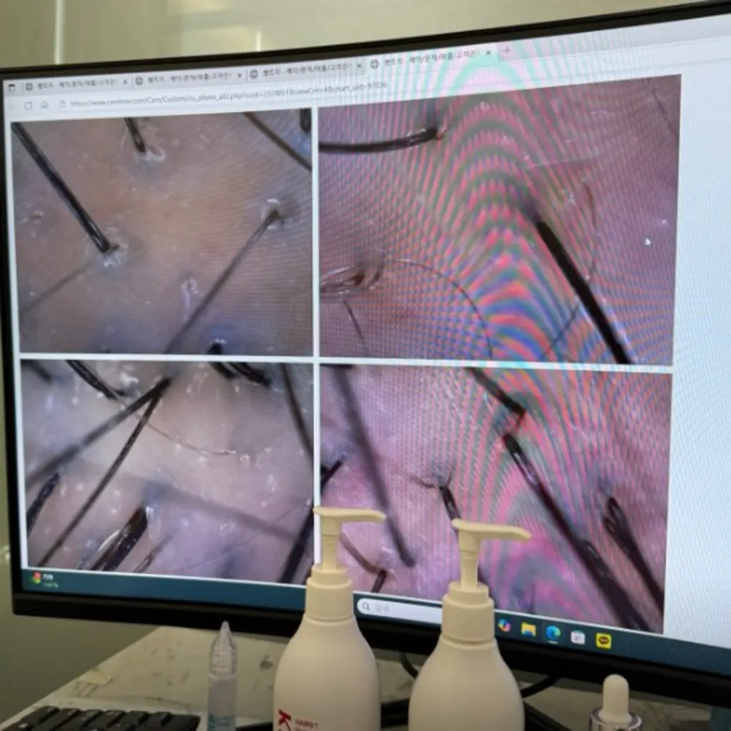 scalp_analysis_microscope_view_82735.webp