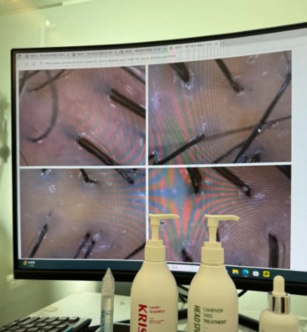 헤드스파K 두피 디톡스 관리