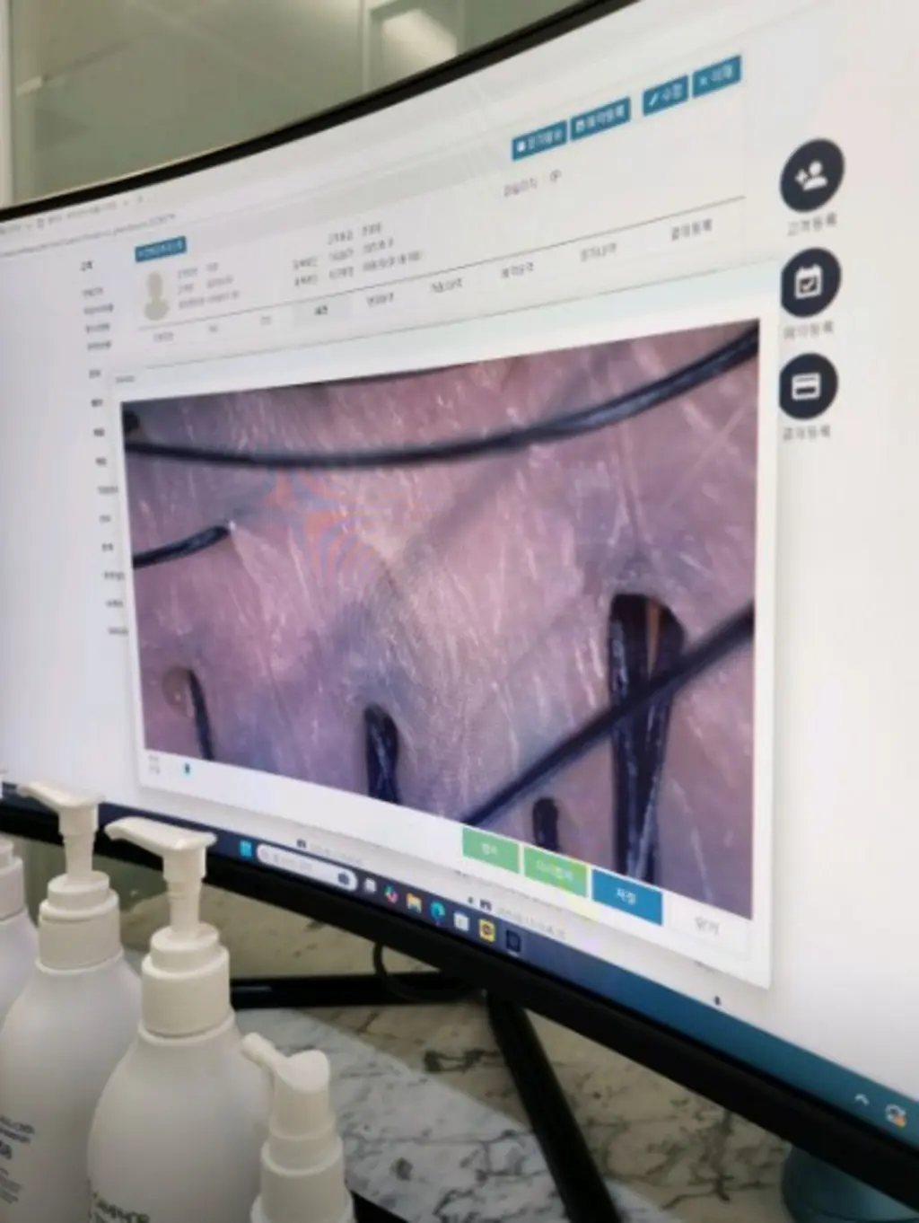 scalp_exam_on_monitor_skin_view_38576.webp